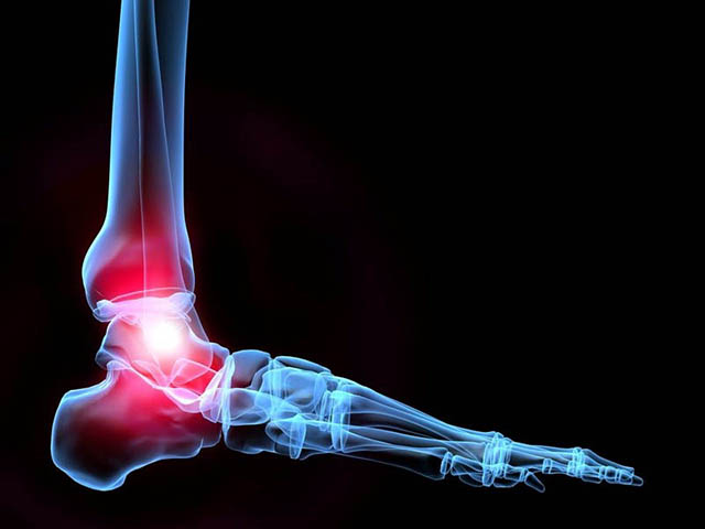 Thoái hóa khớp cổ chân có thể hình thành bởi nhiều nguyên nhân khác nhau