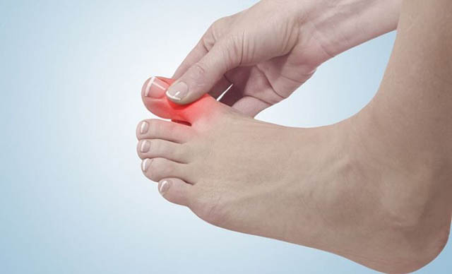 Có nhiều nguyên nhân khác nhau dẫn đến viêm khớp ngón chân