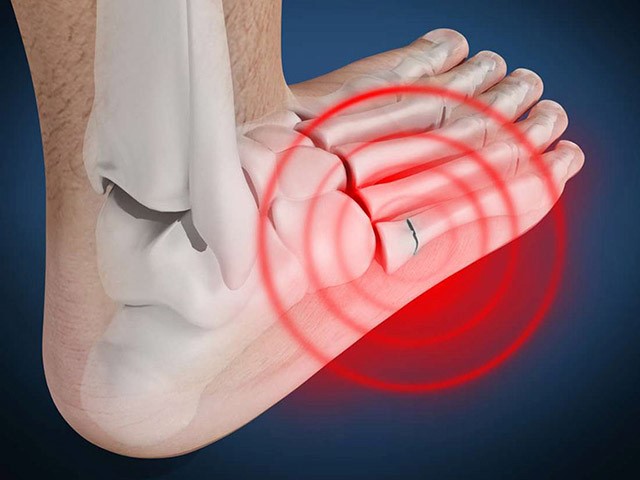 Đau khớp chân: Cách chữa bệnh đau khớp bàn chân