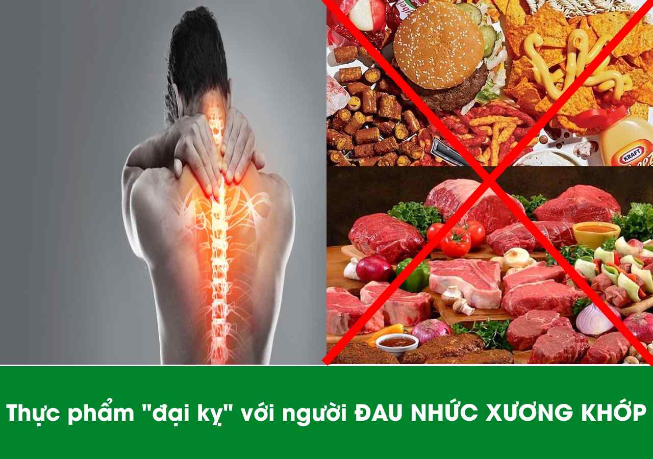 4 thực phẩm “đại kỵ” với người bị đau nhức Xương Khớp