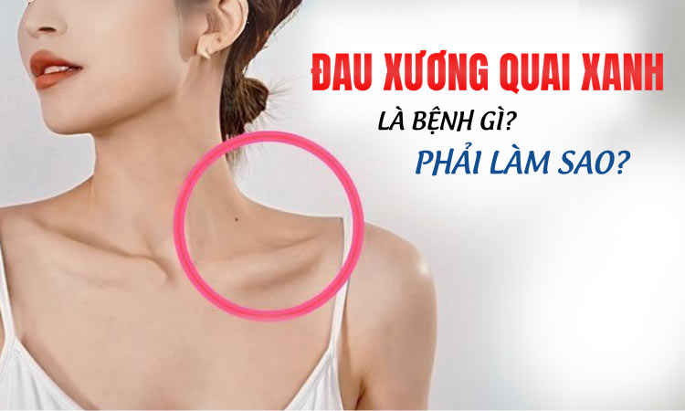 Đau xương quai xanh là bệnh gì? Nguyên nhân và cách khắc phục