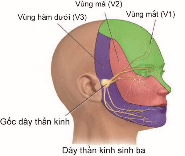 Đau dây thần kinh số 5 là sự tổn thương từ một trong ba nhánh hoặc cả ba nhánh.