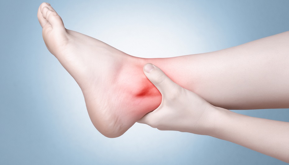 Viêm khớp cổ chân gây đau nhức