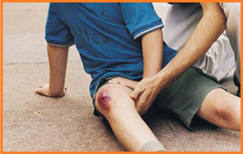 Chấn thương cũng là một trong những nguyên nhân phổ biến gây đau nhức đầu gối