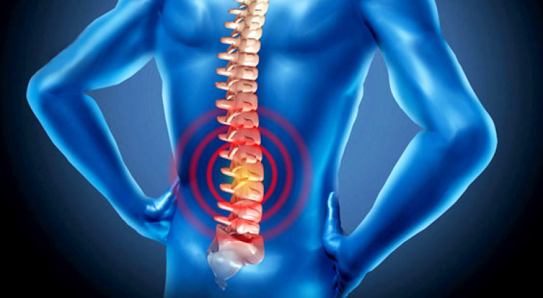Thoái hóa cột sống lưng gây ra những cơn đau khó chịu cho người bệnh