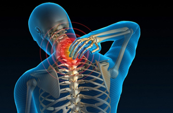 Hình ảnh minh họa thoái hóa đốt sống cổ