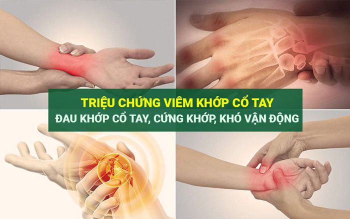 Triệu chứng chính của thoái hóa khớp cổ tay là đau
