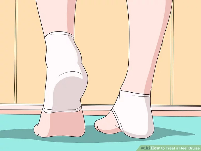 Bảo vệ gót chân bằng miếng lót (Ảnh minh họa)