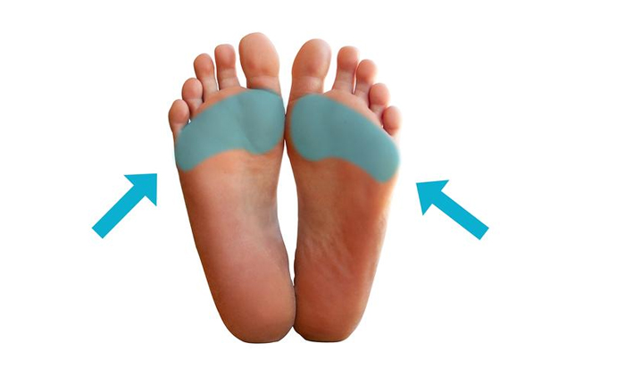 Khu vực metatarsal của bàn chân (vùng khoanh màu xanh)