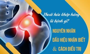 Thoái hóa khớp háng là gì? Những điều cần biết về bệnh thoái hóa khớp háng Thoái hóa khớp háng là gì? Những điều cần biết về bệnh thoái hóa khớp háng