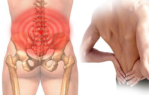 benh-dau-cot-song-lung-1 Nguyên nhân gây bệnh đau cột sống lưng