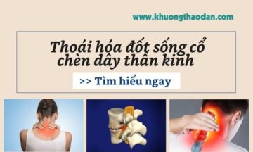thoai-hoa-dot-song-co-chen-day-than-kinh