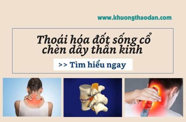 thoai-hoa-dot-song-co-chen-day-than-kinh