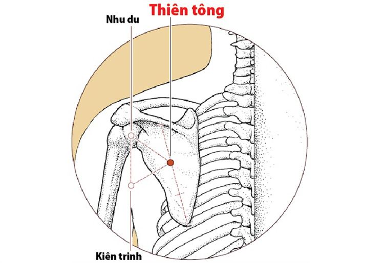 Huyệt Thiên tông thường được tác động khi điều trị các bệnh liên quan đến xơ xương khớp xung quanh cổ vai gáy.