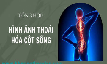 hinh-anh-thoai-hoa-cot-song