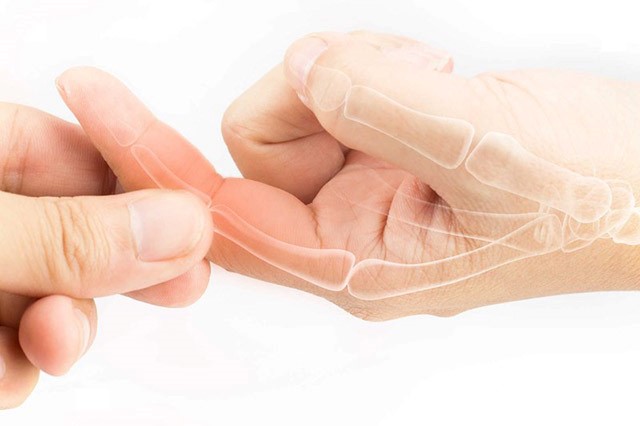 Đau khớp ngón tay có nhiều cách chữa tại nhà khác nhau